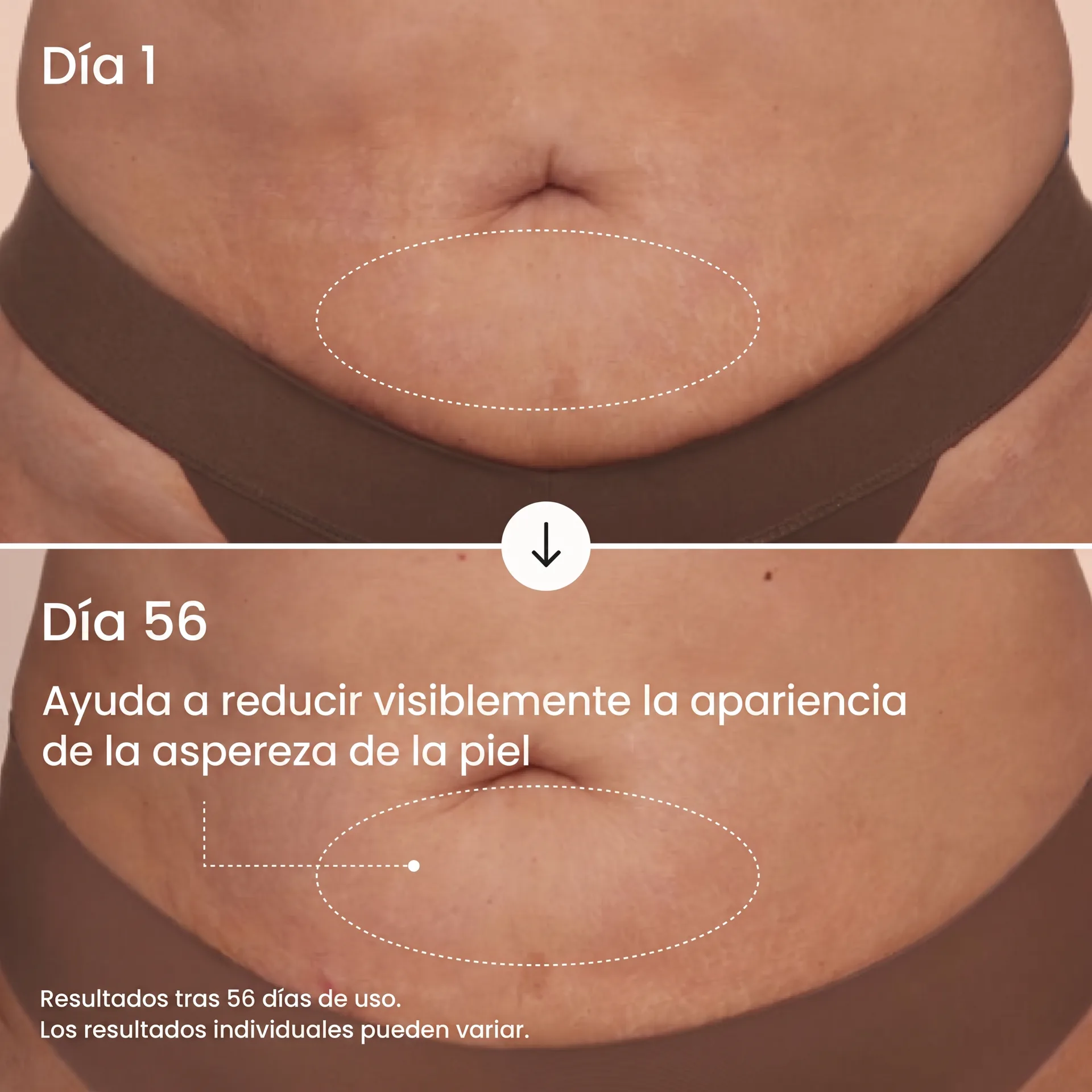 Comparativa de abdomen antes y después de 56 días de uso del producto de referencia