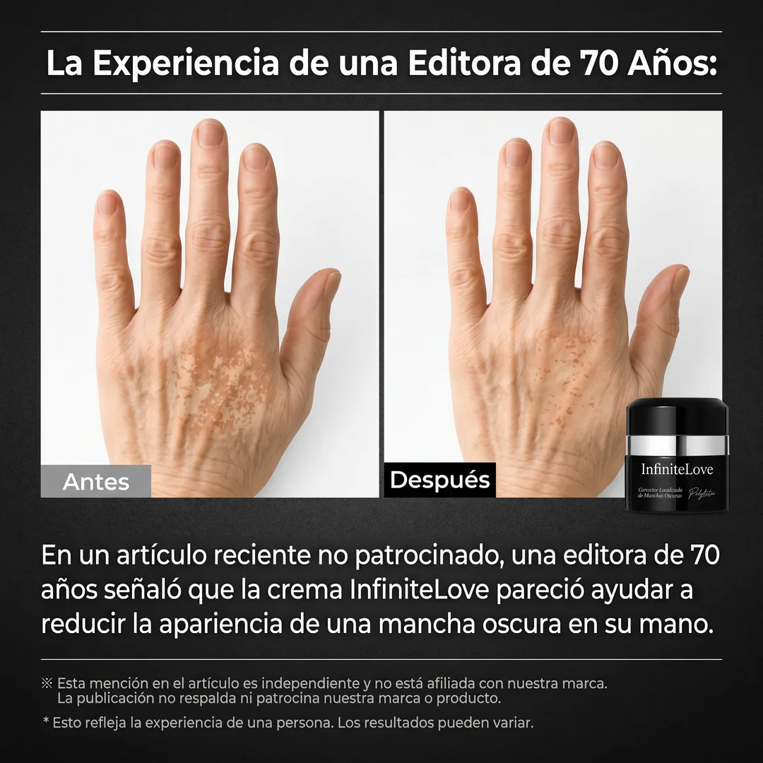 Crema Despigmentante Intensiva – Reduce Manchas y Unifica el Tono