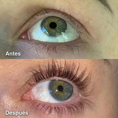 Sérum Crecimiento de Pestañas – Mirada Intensa y Natural