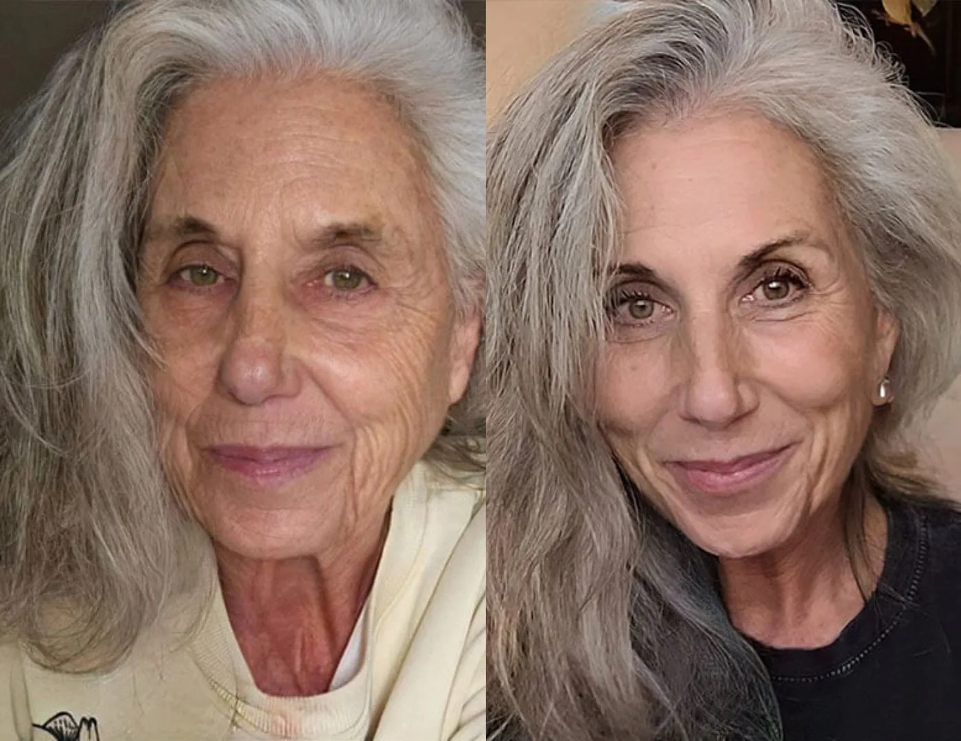 Antes y después Mariola P.
