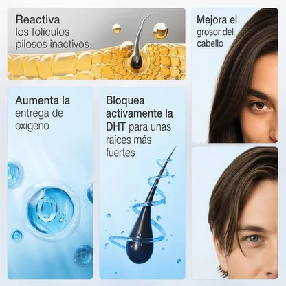 Sérum Capilar Roll-on — Crecimiento y Densidad con 23% de Activos 25 ml