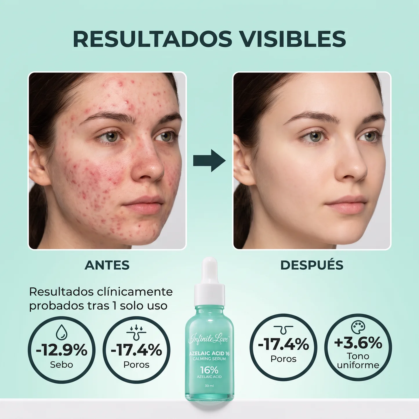 Sérum Calmante con Ácido Azelaico al 16% 30ml
