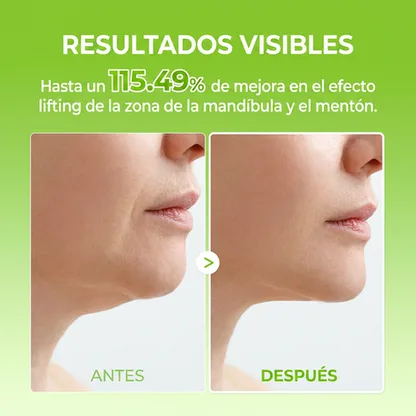 InfiniteLift - Banda Tensora V-Contour Efecto Frío (4 Uds)