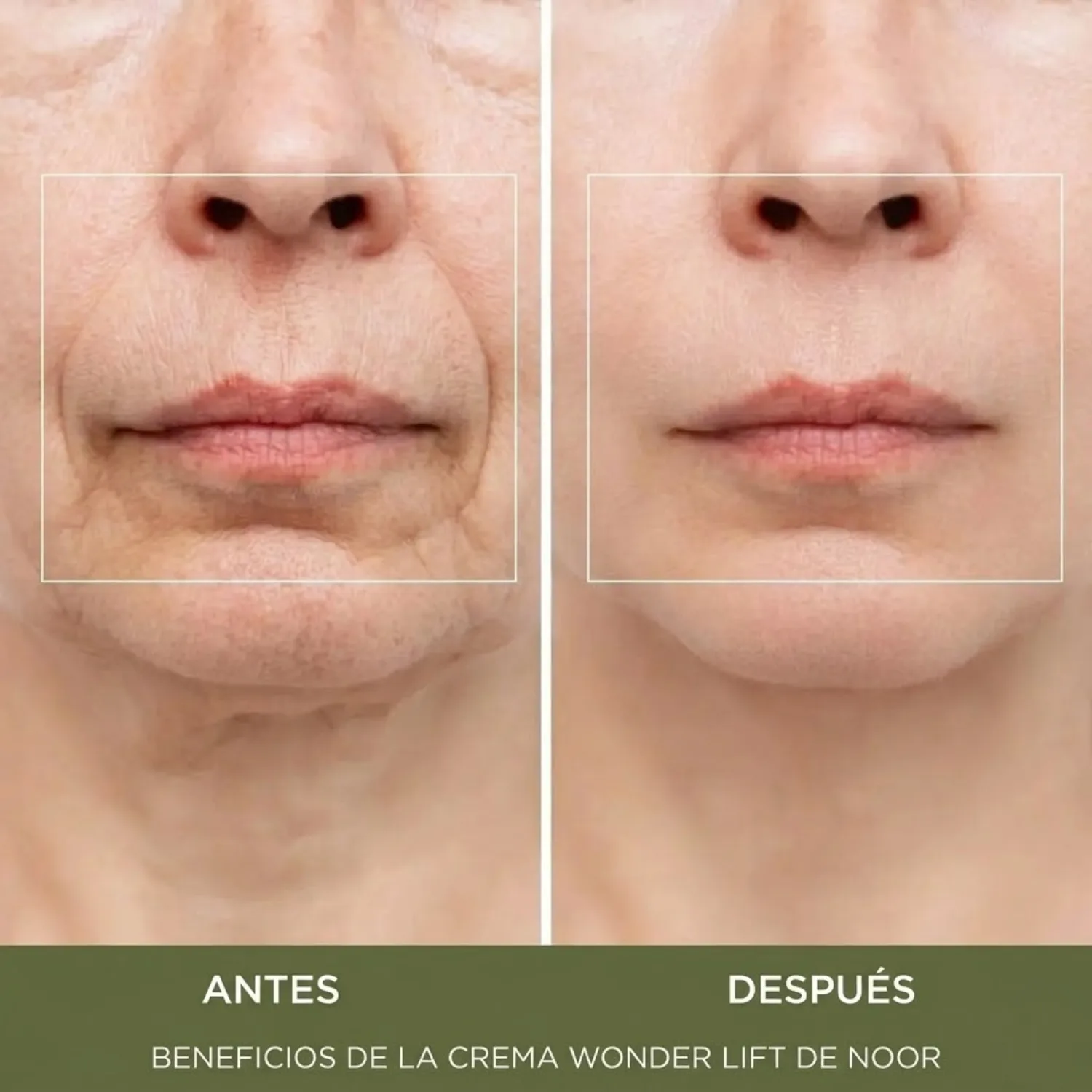 Crema Antiarrugas 'Efecto Botox' Wonder Lift con Péptidos Syn-Ake™ (Resultados en 4 Días)