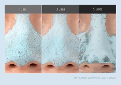 Progresion resultados mascarilla