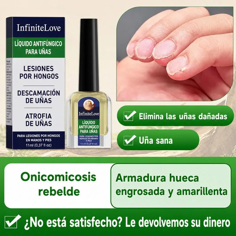 Líquido Antifúngico Uñas Tolnaftato 1% Tratamiento Hongos Manos y Pies 11ml