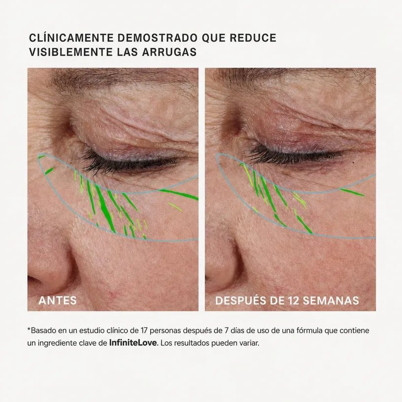 InfiniteLove BioLift — Sérum Reafirmante con Péptidos y Ceramidas 30 ml