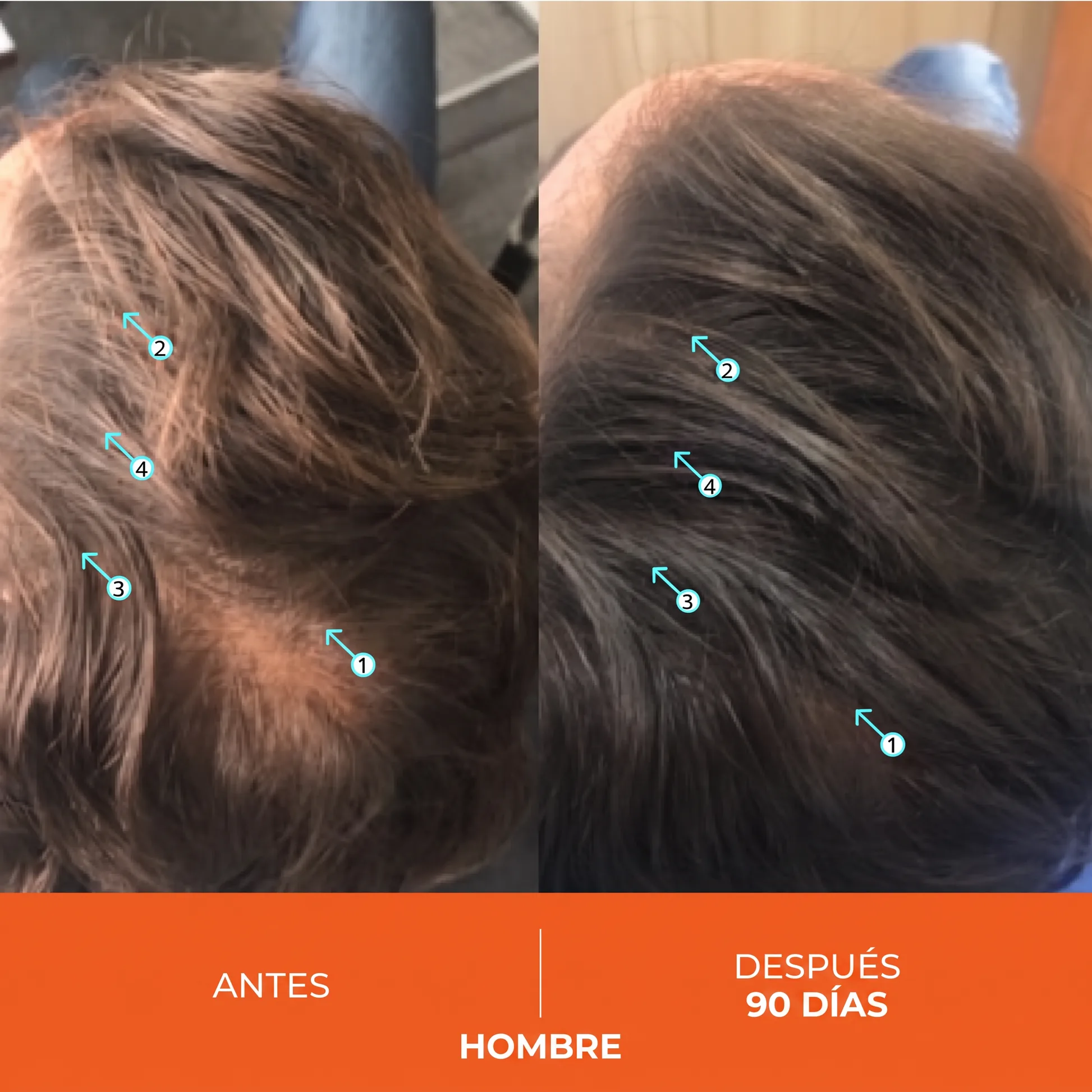 Antes y Después Hombre 90 Días 4 flechas