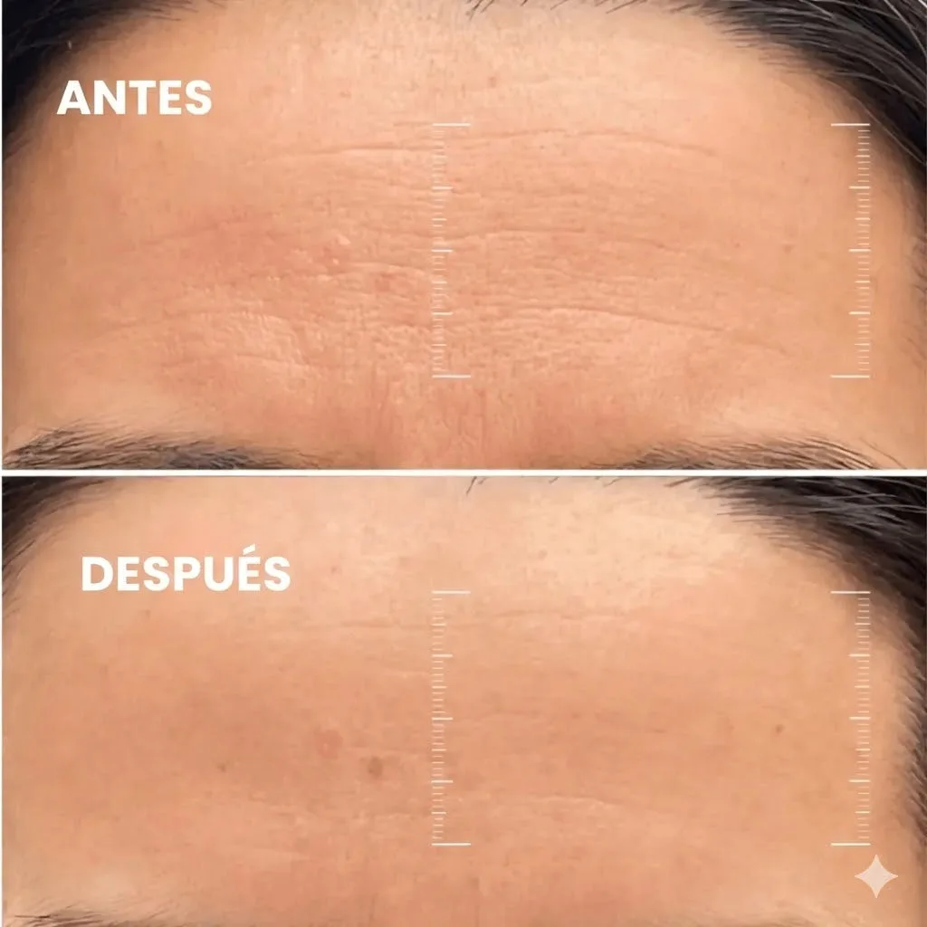 Mascarilla Nocturna de Bio-Colágeno e Hidrogel para Poros Dilatados, Hidratación Profunda y Efecto 'Glass Skin' (Se vuelve Transparente)