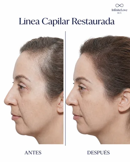 Sérum Capilar de Crecimiento