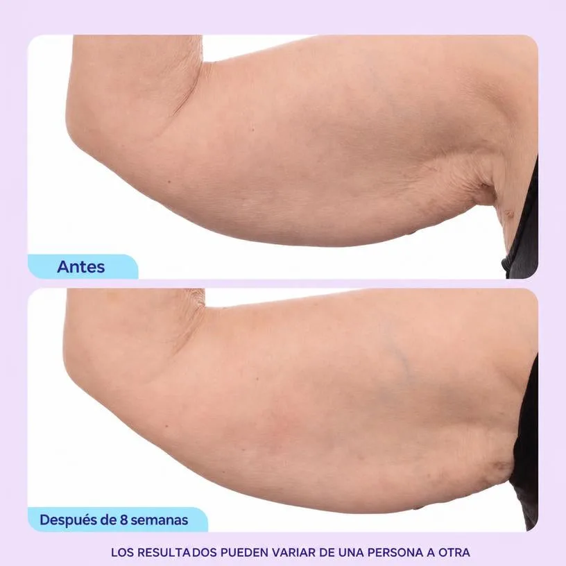 Crema Reafirmante y Tonificante para Brazos 7% Complejo ProTight Ashwagandha Anti-Flacidez 100ml